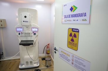Brasília (DF) 23/10/2025 - Equipamento de mamografia da carreta de saúde da mulher do programa Agora Tem Especialistas no estacionamento do Hospital Regional de Ceilândia, cidade satélite de Brasília Foto: Fabio Rodrigues-Pozzebom/ Agência Brasil