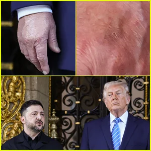 Muitos estão ampliando as mãos de Donald Trump novamente à medida que novas imagens surgem, a Casa Branca responde com a mesma declaração