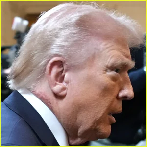 O pescoço de Donald Trump parece ter uma marca semelhante a uma erupção cutânea em novas fotos