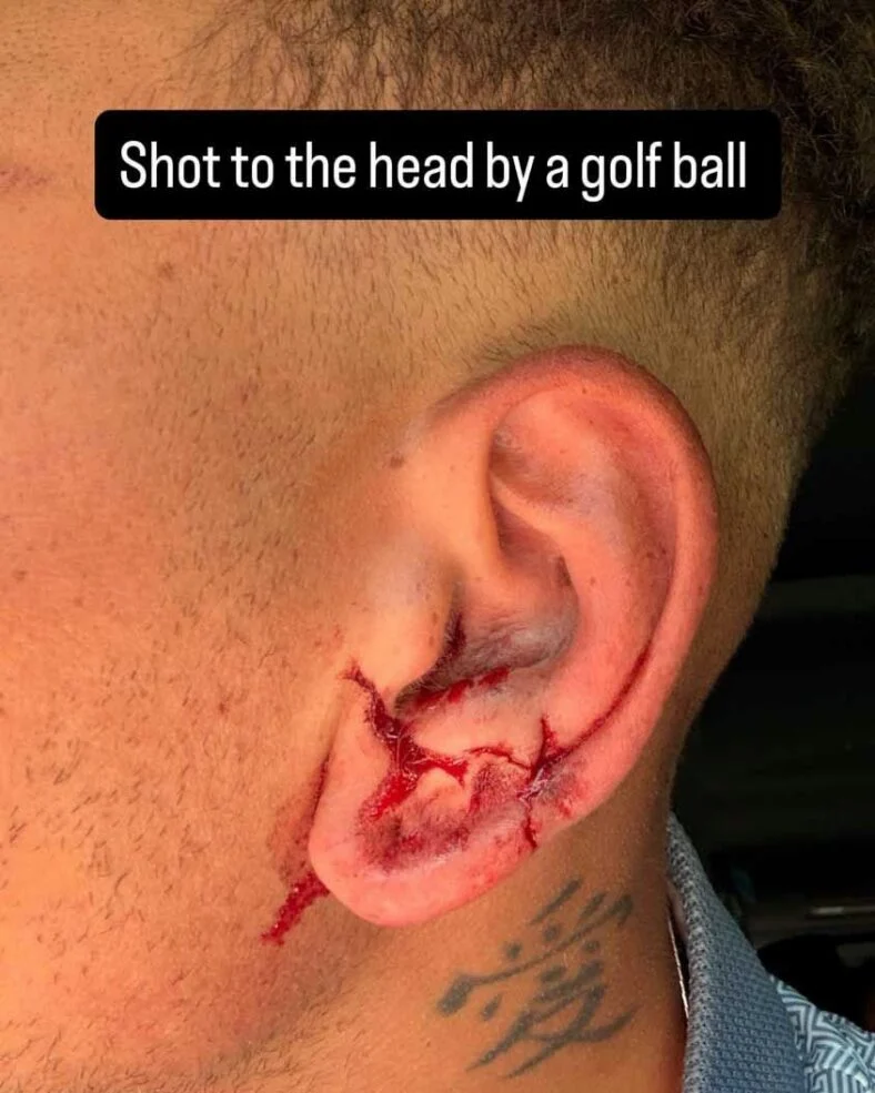 Kane Brown é atingido na cabeça por uma bola de golfe