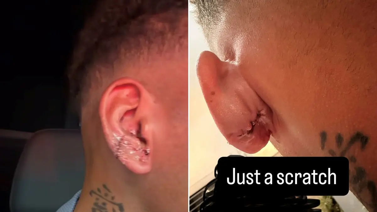 Kane Brown injured ear