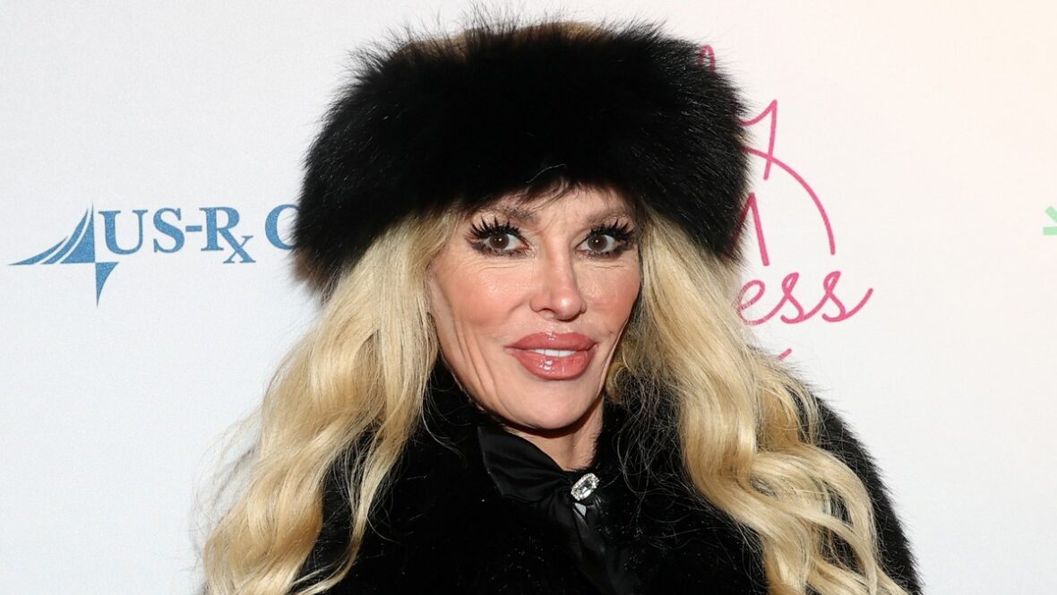 tumor facial de brandi-glanville Brandi Glanville é diagnosticada com tumor no rosto