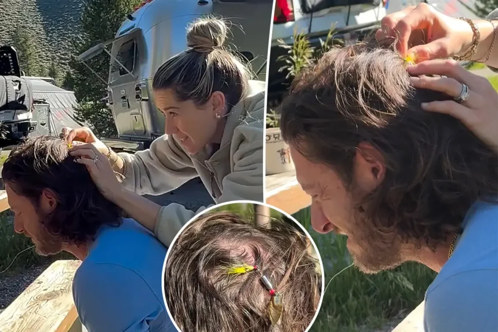 Cantor Tyler Hubbard, do Florida Georgia Line, fica com anzol preso na cabeça durante acampamento