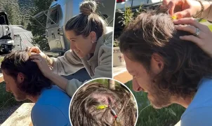 Cantor Tyler Hubbard, do Florida Georgia Line, fica com anzol preso na cabeça durante acampamento