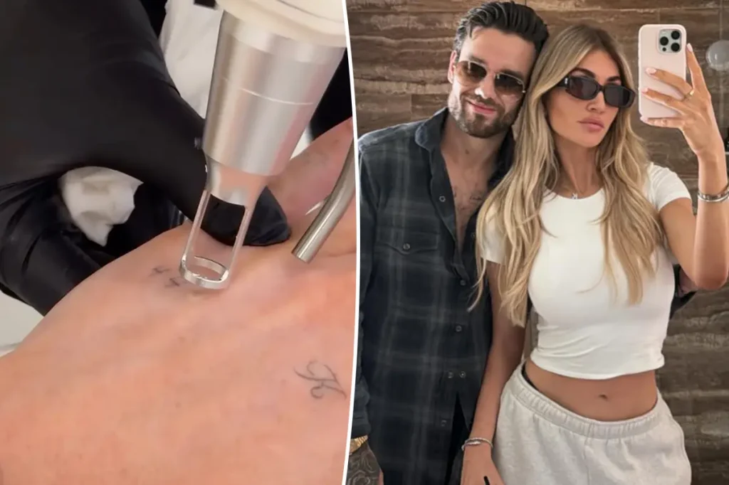Kate Cassidy remove tatuagem em homenagem a Liam Payne e diz que fará novo desenho