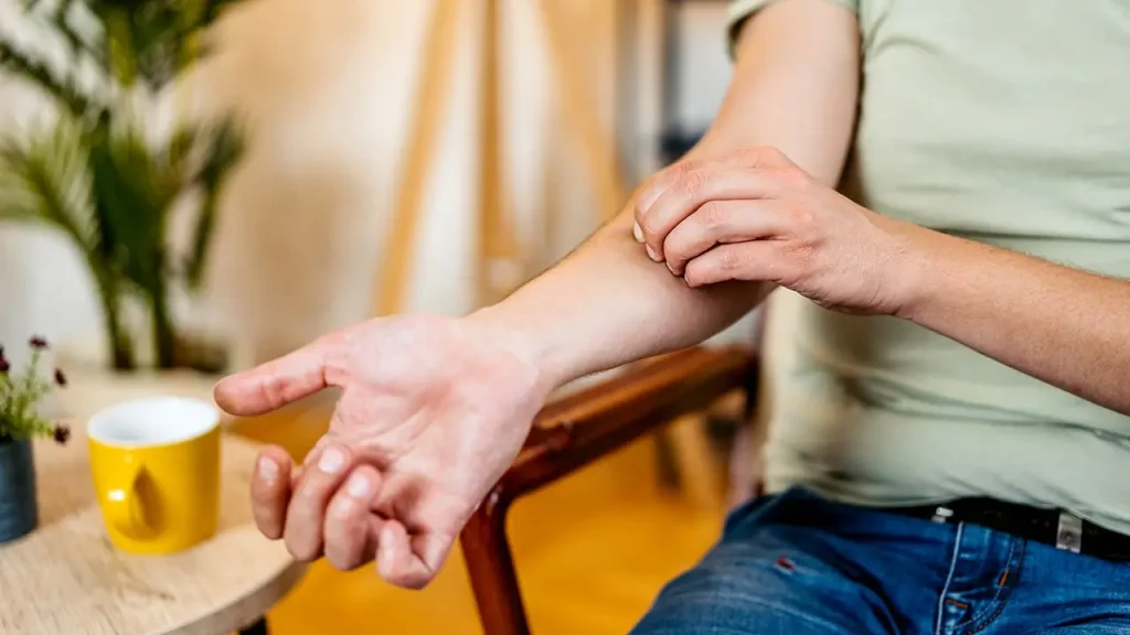 Coçar a pele agrava inflamação e eczema, mas pode ter um lado positivo, aponta estudo