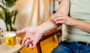 Scratching an itch worsens eczema and skin inflammation, study finds