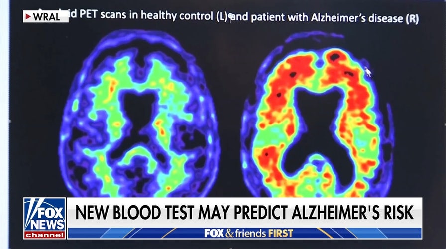 New blood test may predict Alzheimer