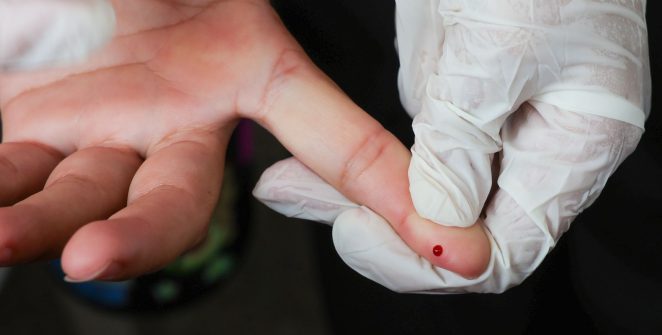 Brasil cumpre meta internacional e pede certificação de eliminação da transmissão vertical da hepatite B