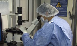 Novos casos de remissão do HIV após transplante de células-tronco são anunciados no Rio