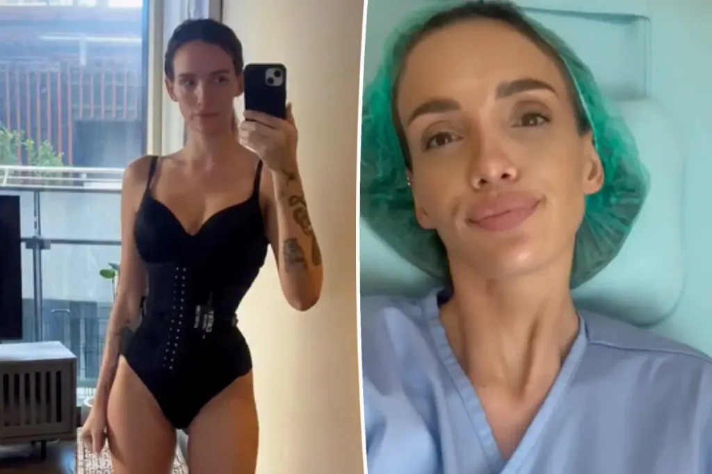 Ex-participante de reality mostra resultado de cirurgia para afinar a cintura: Melhor coisa que fiz