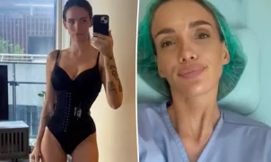 Ex-participante de reality mostra resultado de cirurgia para afinar a cintura: Melhor coisa que fiz