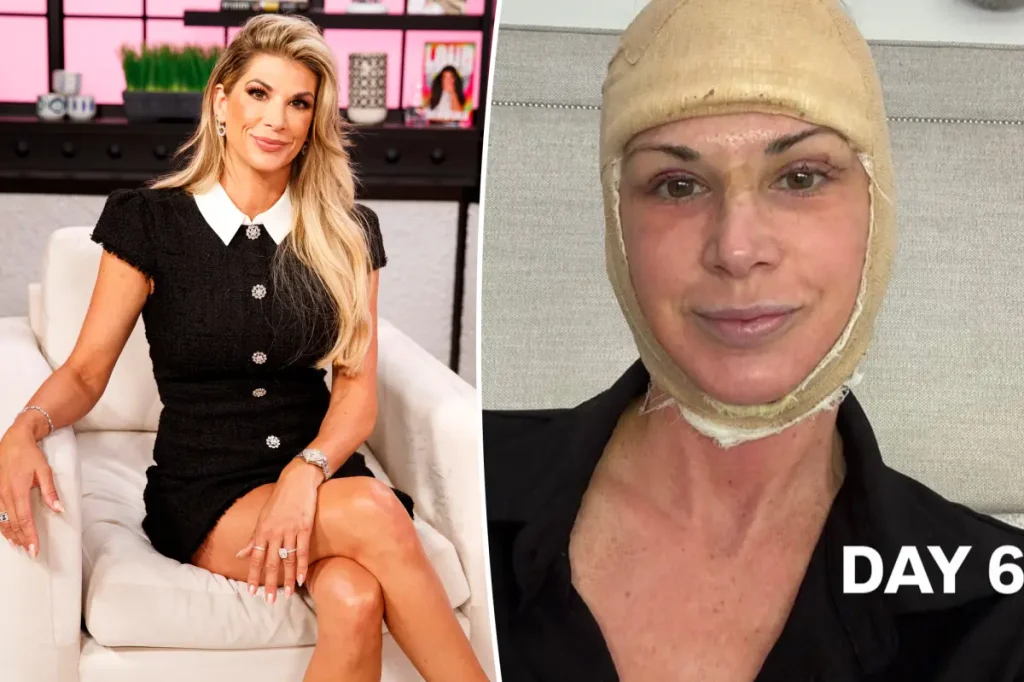 Ex-participante de ‘Real Housewives of Orange County’ faz facelift antes de completar 50 anos