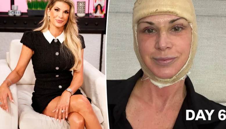 Ex-participante de ‘Real Housewives of Orange County’ faz facelift antes de completar 50 anos