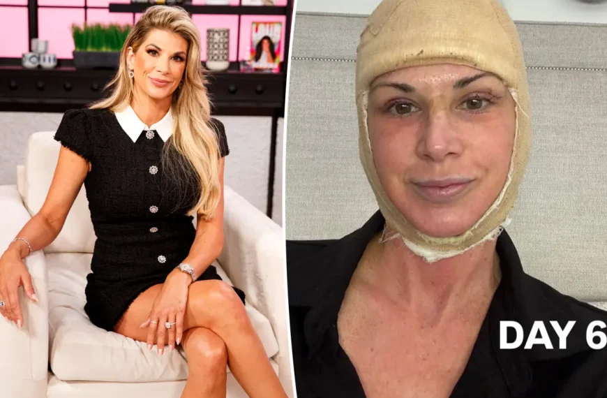 Ex-participante de ‘Real Housewives of Orange County’ faz facelift antes de completar 50 anos