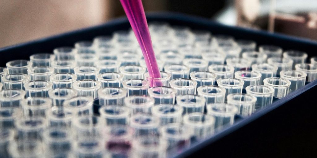 Diagnóstico precoce da AME é decisivo para qualidade de vida, apontam especialistas