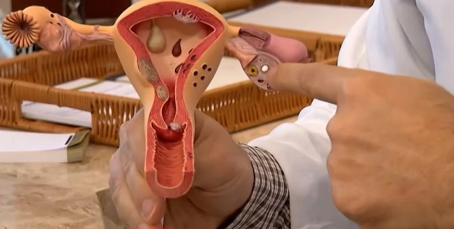 CNPq abre seleção com R$ 60 milhões para pesquisas sobre endometriose e saúde menstrual