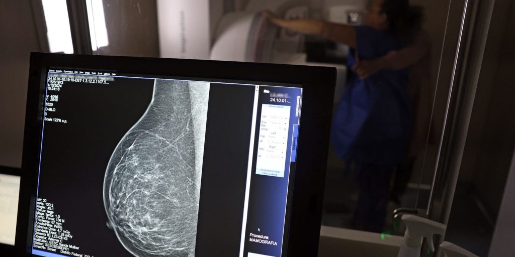ANS amplia cobertura de mamografia digital para todas as idades a partir de outubro