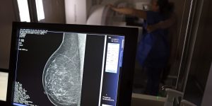 ANS amplia cobertura de mamografia digital para todas as idades a partir de outubro