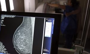 ANS amplia cobertura de mamografia digital para todas as idades a partir de outubro