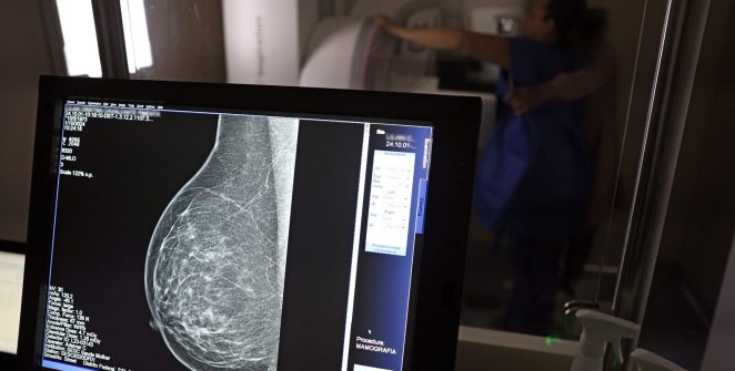 ANS amplia cobertura de mamografia digital para todas as idades a partir de outubro