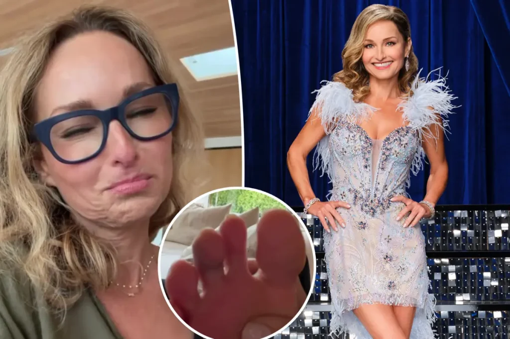 Giada De Laurentiis exibe lesão no pé antes de estreia no Dancing With the Stars: Com certeza vou perder a unha do dedo