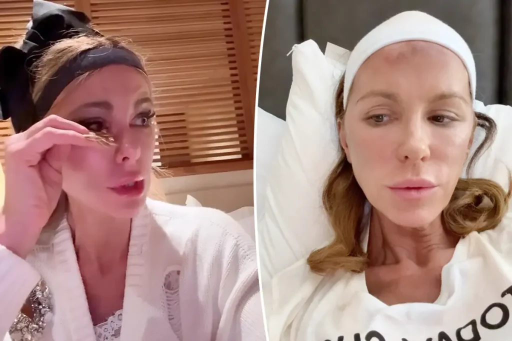 Kate Beckinsale publica mensagens alarmantes semanas após relatar luta contra estresse pós-traumático