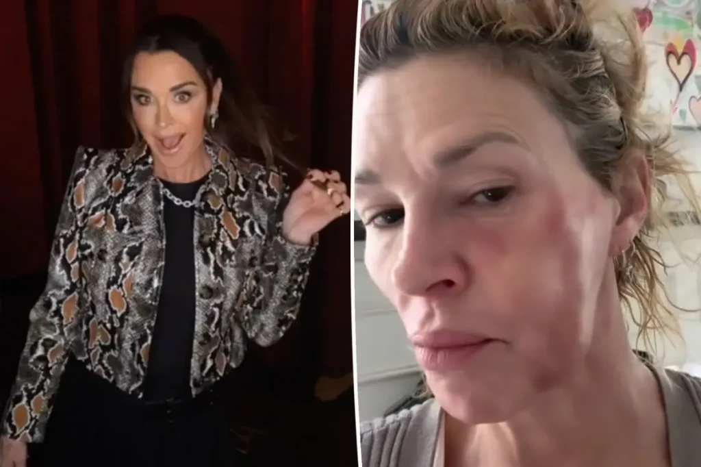 Brandi Glanville agradece doação de Kyle Richards a vaquinha para despesas médicas