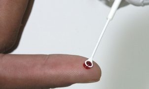 Fiji declara emergência nacional de HIV após casos crescerem 16 vezes em cinco anos