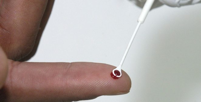 Fiji declara emergência nacional de HIV após casos crescerem 16 vezes em cinco anos