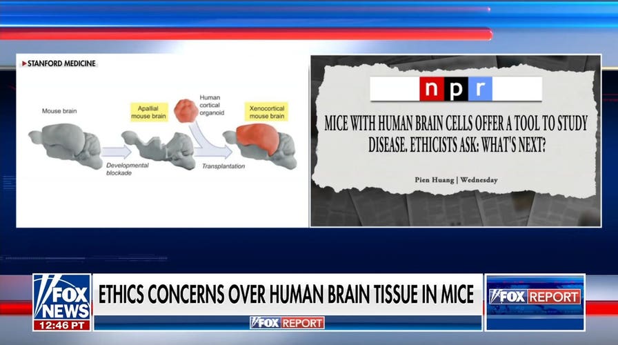 Stanford researchers face ethics concerns over transplanting human brain tissue to mice