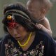 Ministério da Saúde envia expedição a Surucucu para atender 750 procedimentos no território Yanomami