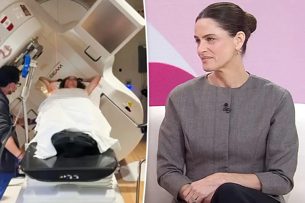 Amanda Peet revela sintoma estranho que antecedeu diagnóstico de câncer de mama