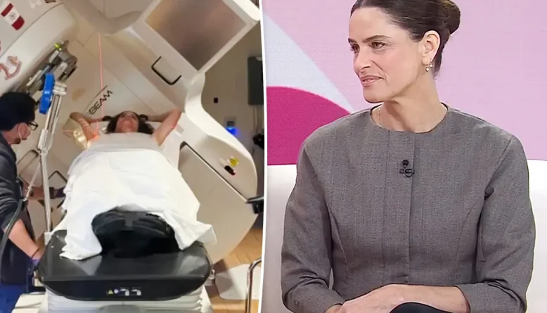 Amanda Peet revela sintoma estranho que antecedeu diagnóstico de câncer de mama