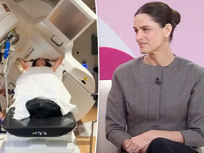 Amanda Peet revela sintoma estranho que antecedeu diagnóstico de câncer de mama