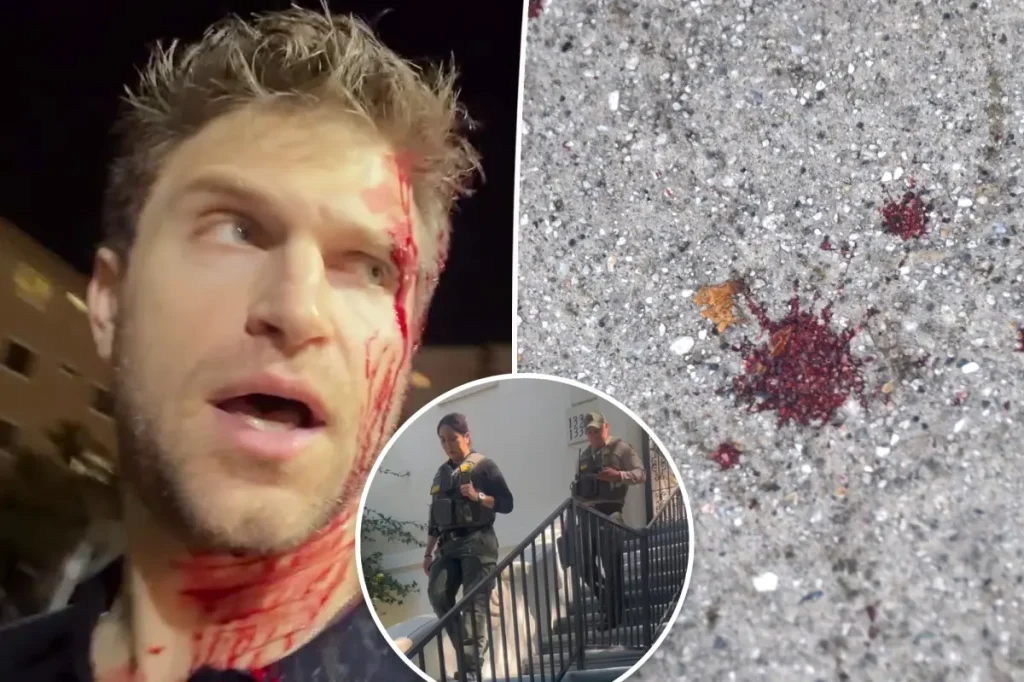 Deputados deixam residência de Keegan Allen enquanto prossegue investigação sobre ataque em supermercado
