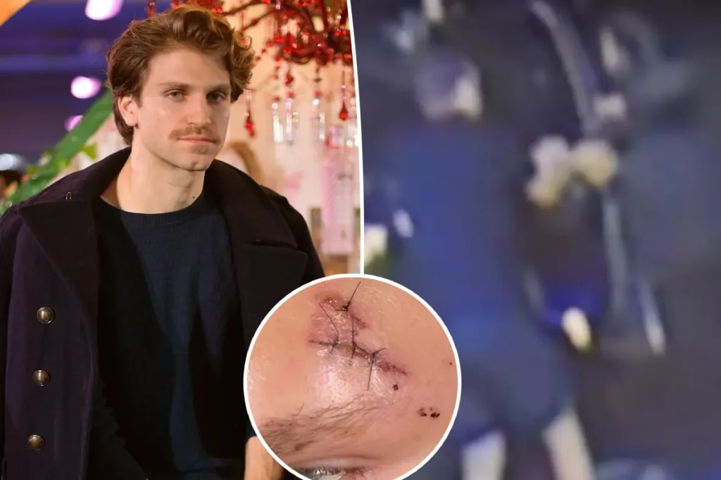 Ator Keegan Allen é assaltado à mão armada e com faca em West Hollywood