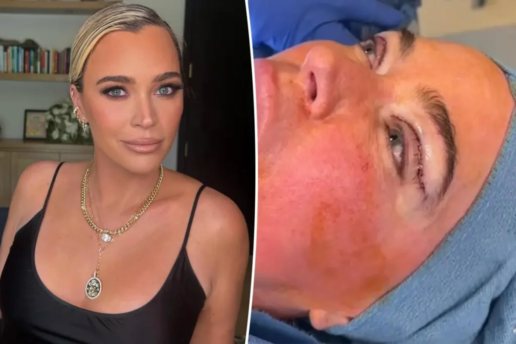 Teddi Mellencamp defende cirurgia plástica durante tratamento de câncer em estágio 4