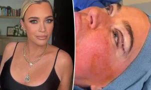 Teddi Mellencamp defende cirurgia plástica durante tratamento de câncer em estágio 4