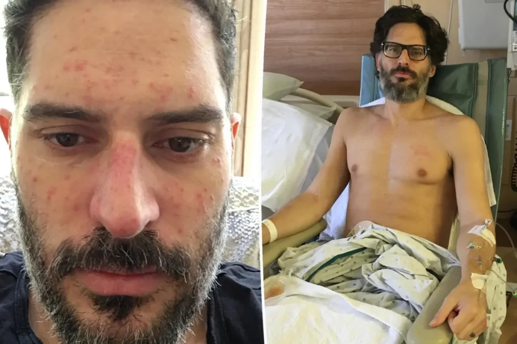 Joe Manganiello revela amputação em meio a batalha contra doença misteriosa