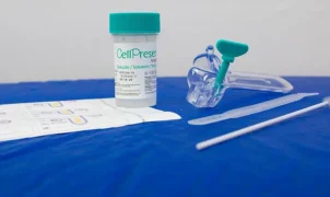 Exame DNA-HPV no SUS já registra 9.904 resultados positivos para vírus de alto risco