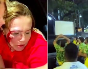 Vereadora Iara Pimentel é atingida no rosto durante carreata em Montes Claros