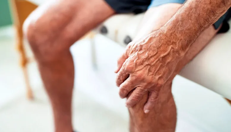 Non-surgical knee osteoarthritis procedure cut pain in 80% of patients for year