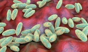 US presses Russia for answers after suspected fatal plague case surfaces