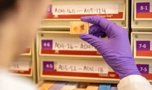 Records show $765 procurement fee per organ after detailed investigation